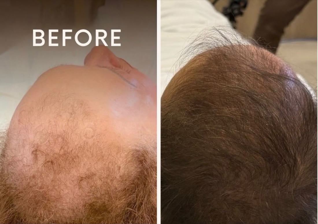 Antes e depois tratamento capilar — Instituto Amabilia