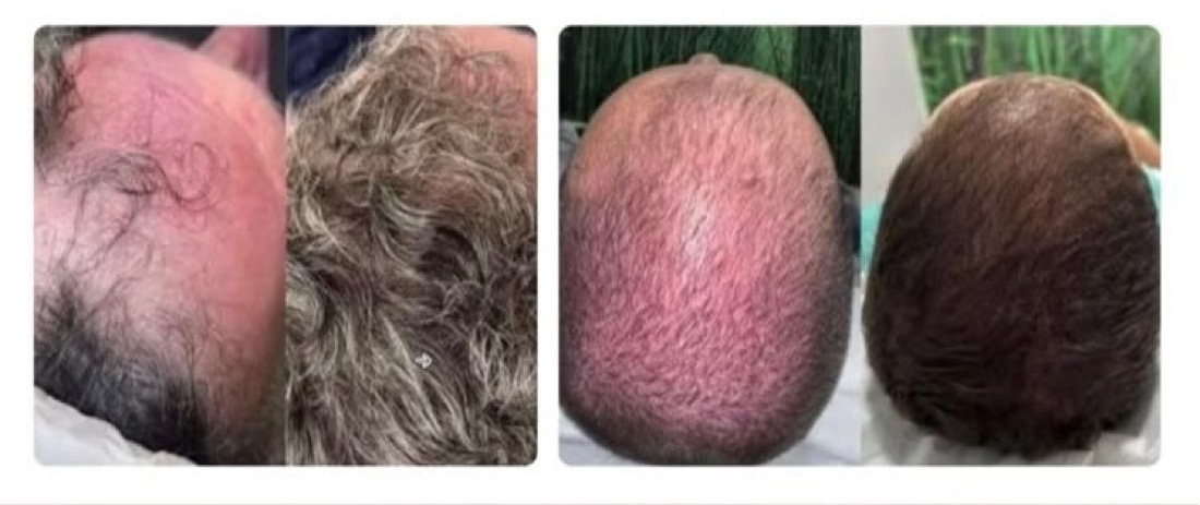 Antes e depois tratamento capilar — Instituto Amabilia