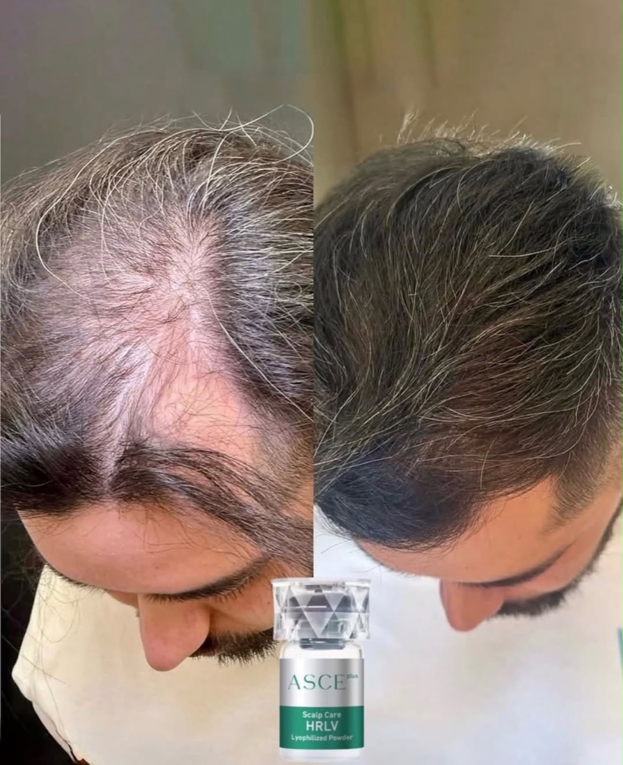 Antes e depois tratamento capilar — Instituto Amabilia