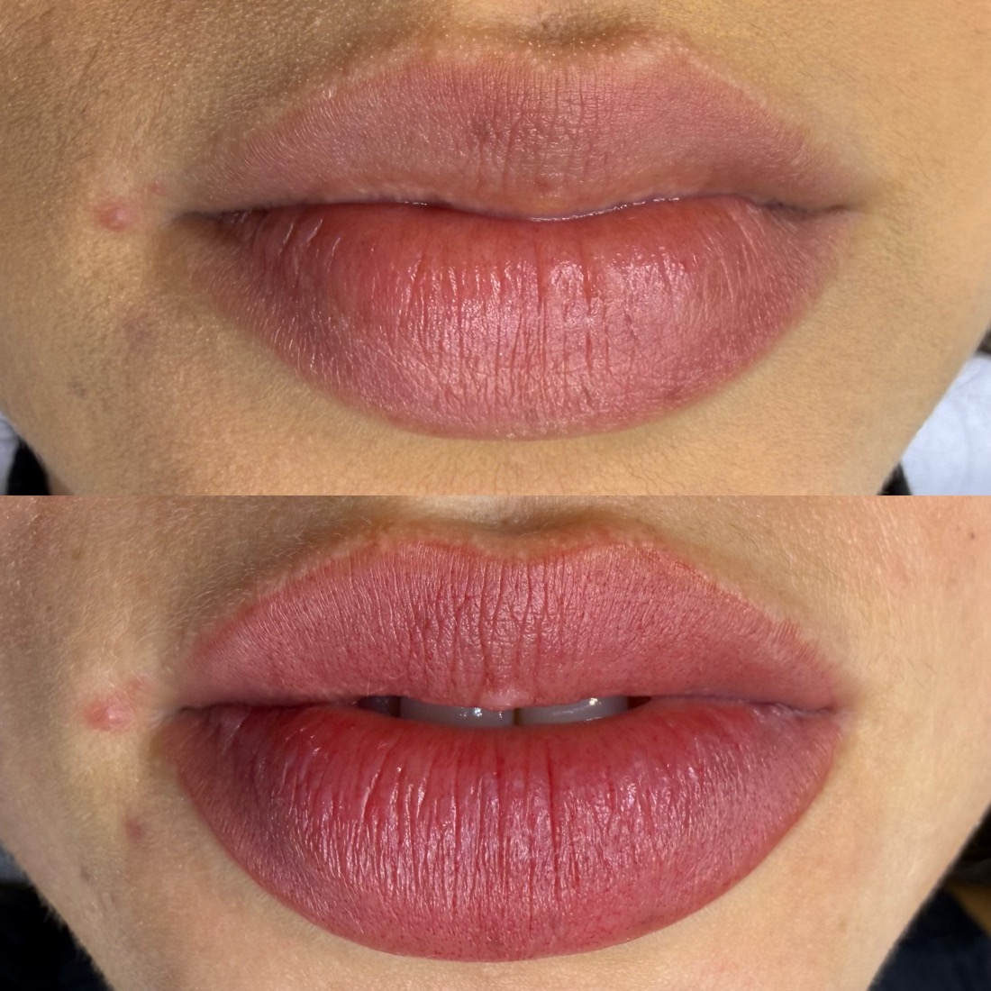 Antes e depois micropigmentação labial — Instituto Amabilia